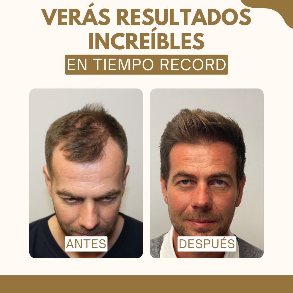 CREMA DE JENGIBRE™️ - Di adiós a la caída del pelo en pocos días
