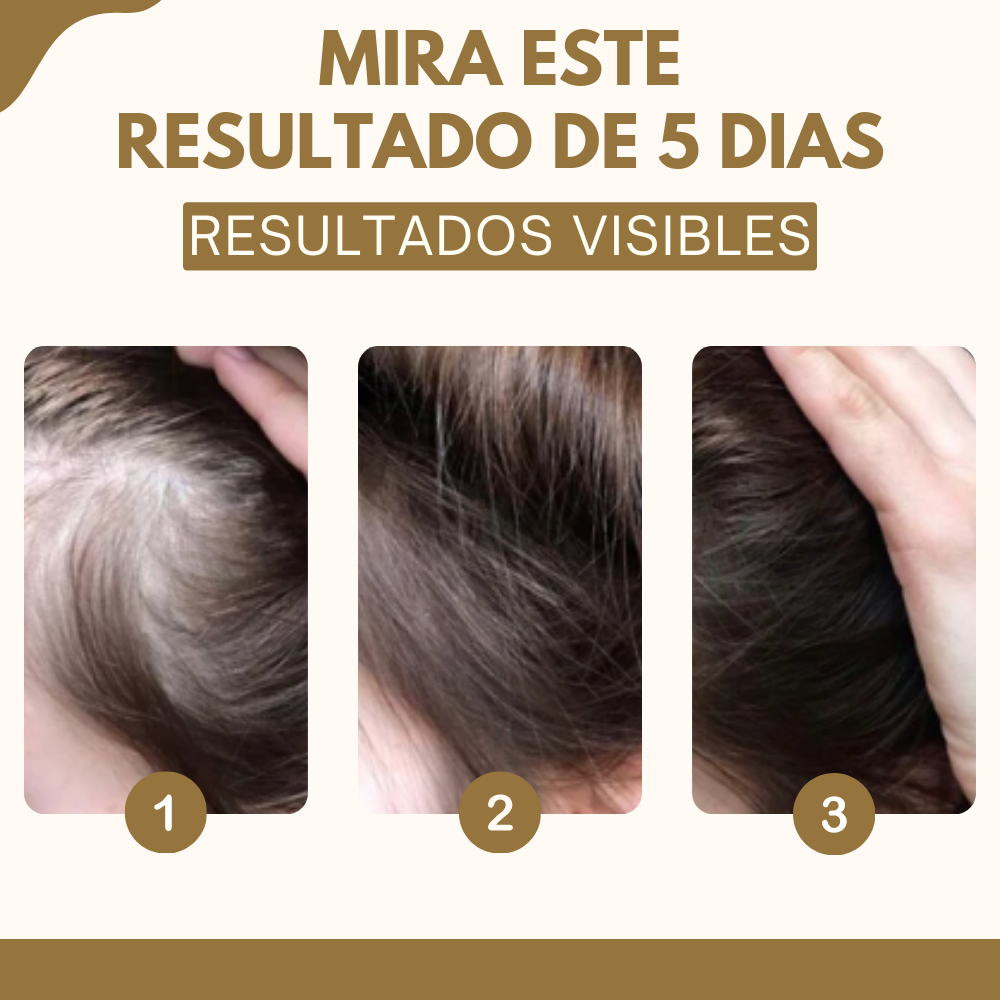 CREMA DE JENGIBRE™️ - Di adiós a la caída del pelo en pocos días